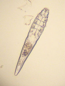Demodex